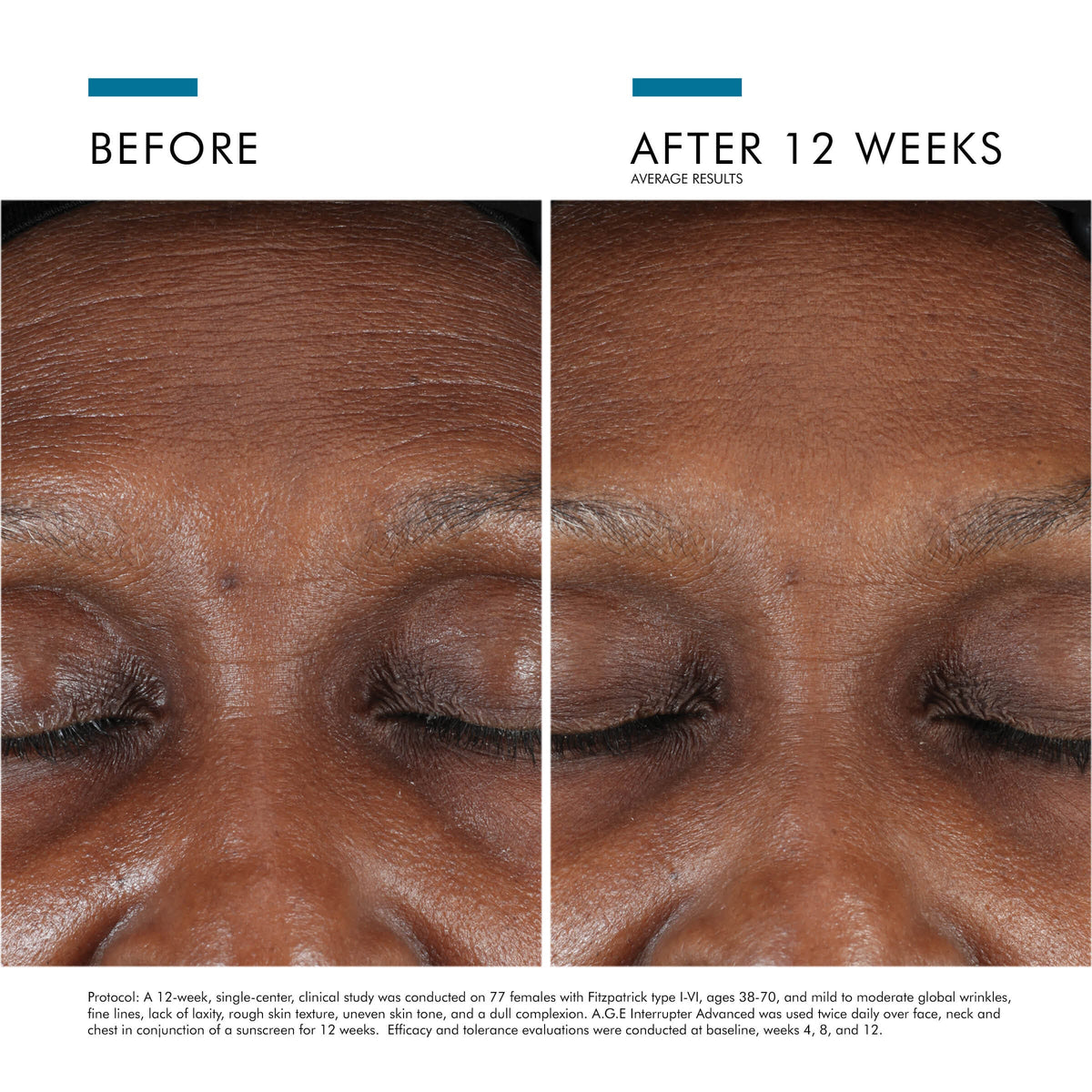 SkinCeuticals SkinCeuticals - A.G.E. INTERRUPTER - photo 10