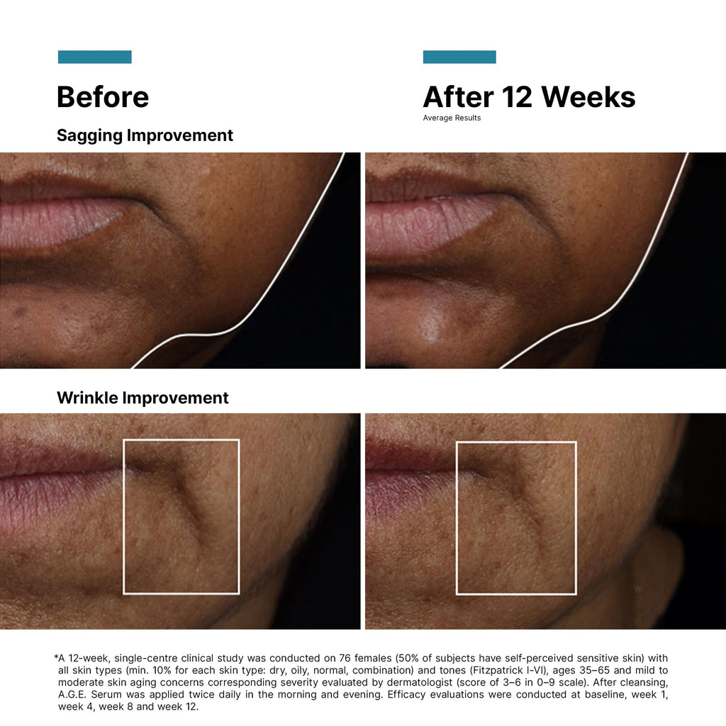SkinCeuticals SkinCeuticals - A.G.E Interrupter Ultra Serum - photo 10