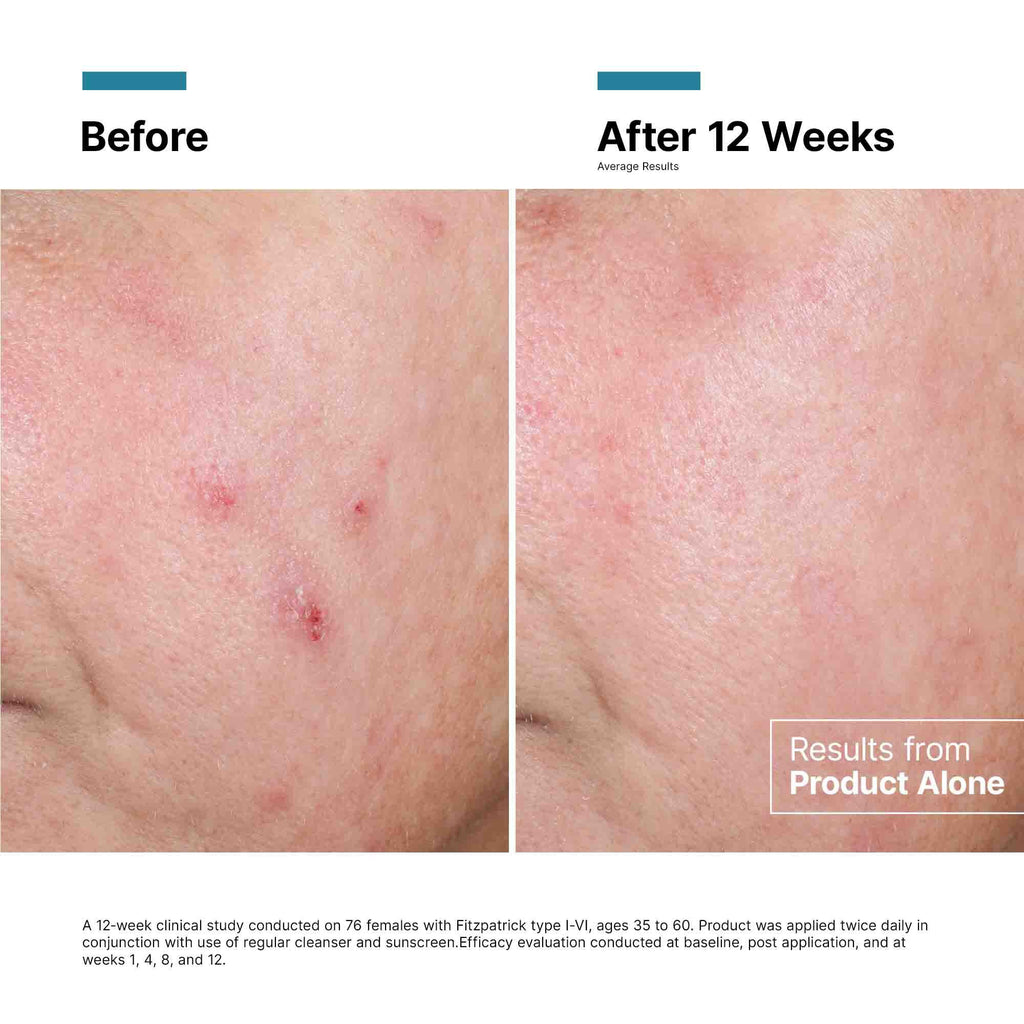 SkinCeuticals SkinCeuticals - Advanced RGN-6 Rejuvenation & Repair Cream - photo 4