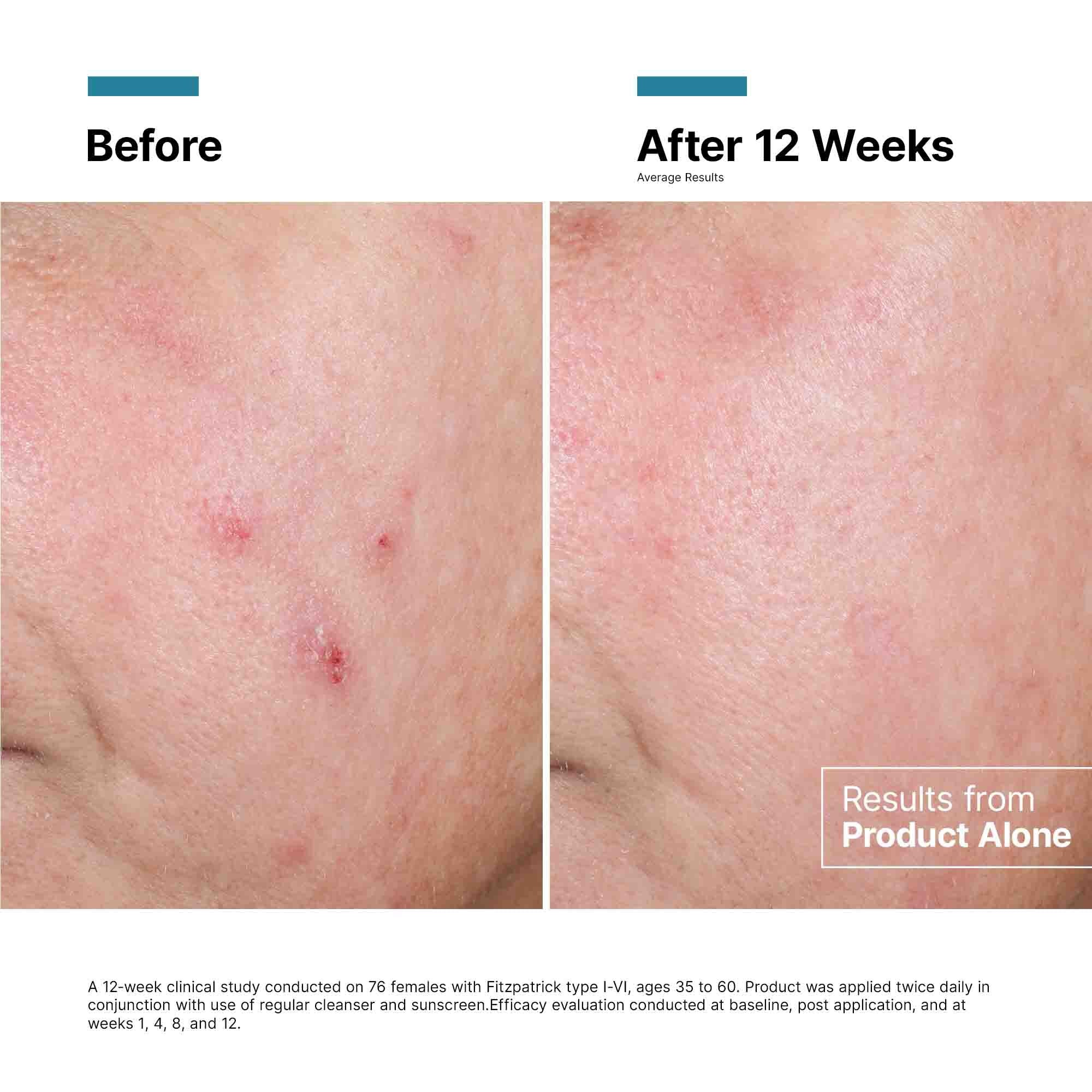 SkinCeuticals SkinCeuticals - Advanced RGN-6 Rejuvenation & Repair Cream - photo 4