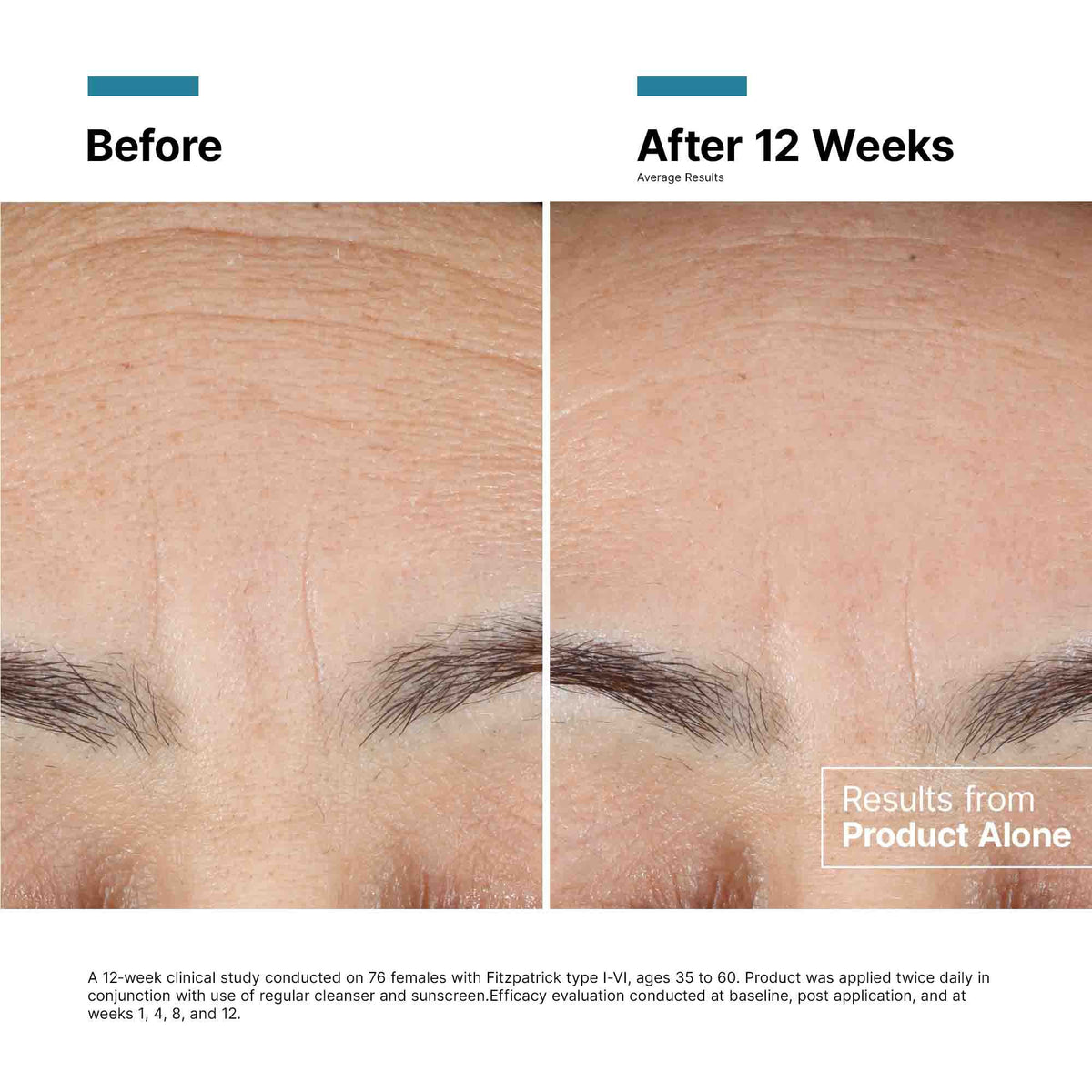 SkinCeuticals SkinCeuticals - Advanced RGN-6 Rejuvenation & Repair Cream - photo 5
