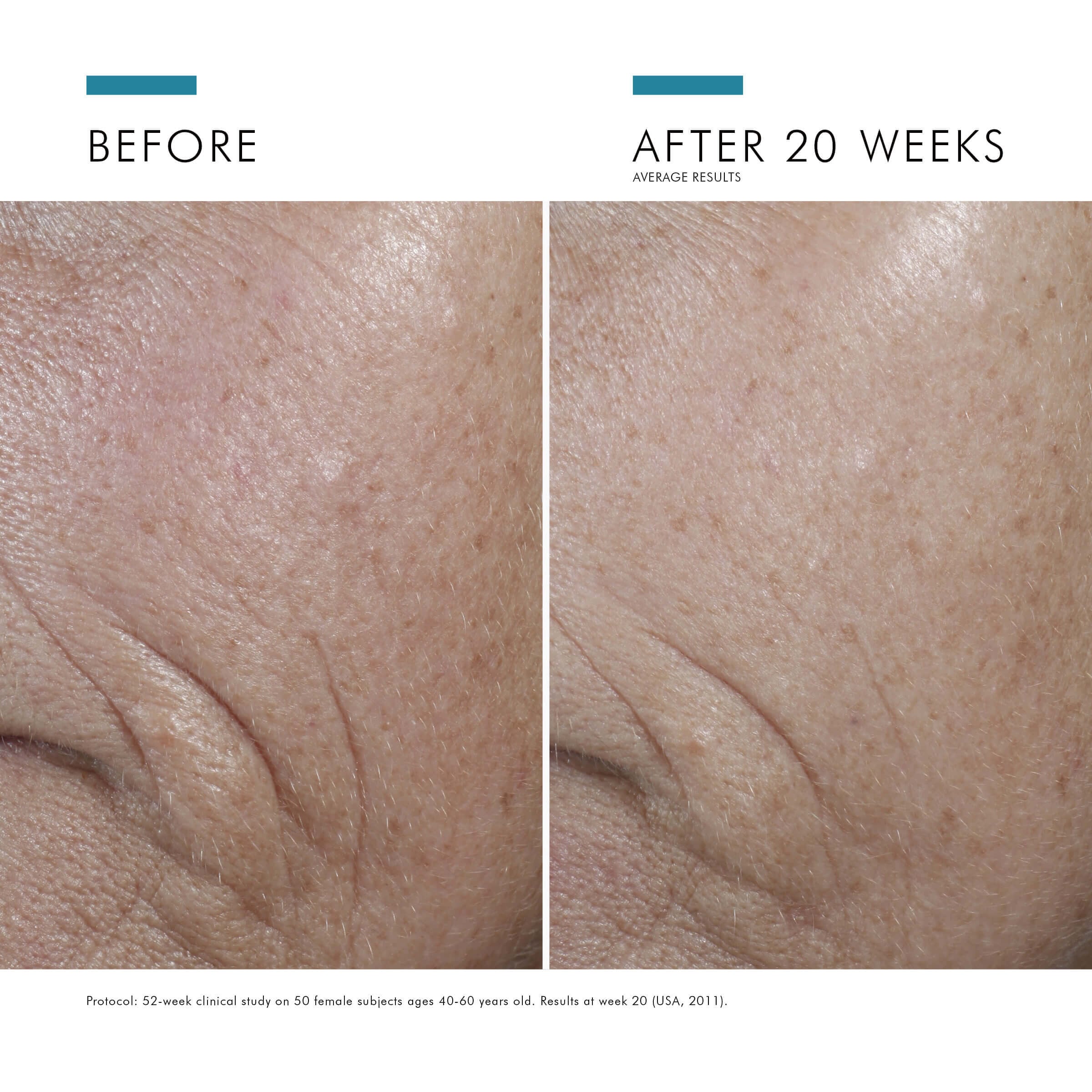 SkinCeuticals SkinCeuticals - C E FERULIC® WITH 15% L-ASCORBIC ACID - photo 12