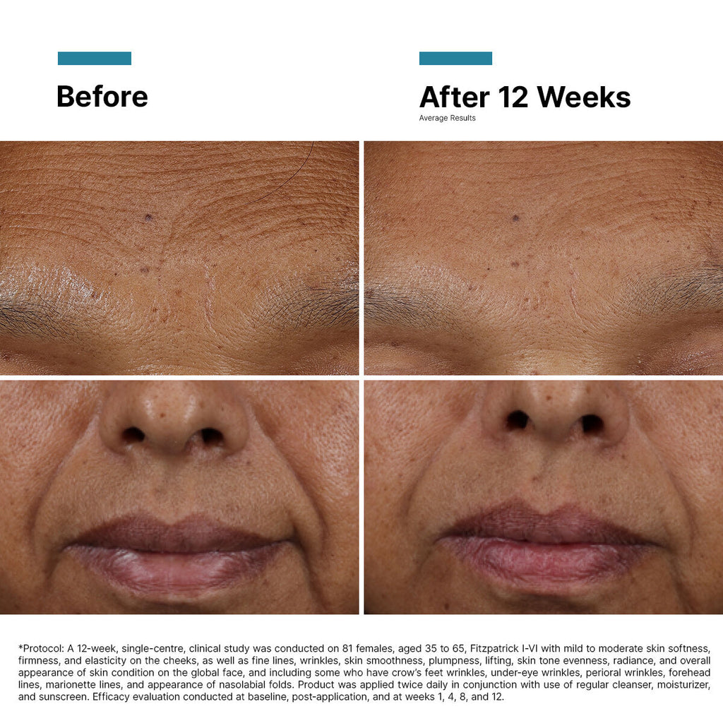 SkinCeuticals SkinCeuticals - HA Intensifier Multi-Glycan - photo 3