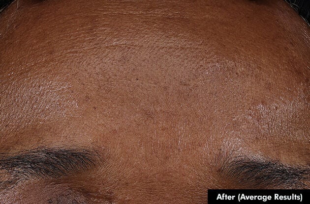 SkinCeuticals SkinCeuticals - P-TIOX SERUM - photo 3
