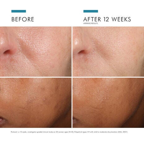 SkinCeuticals SkinCeuticals - PHLORETIN CF® WITH FERULIC ACID - photo 7