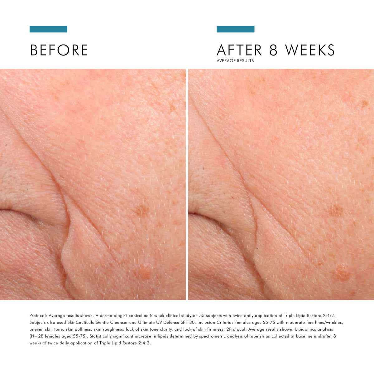 SkinCeuticals SkinCeuticals - TRIPLE LIPID RESTORE 2:4:2 - photo 7